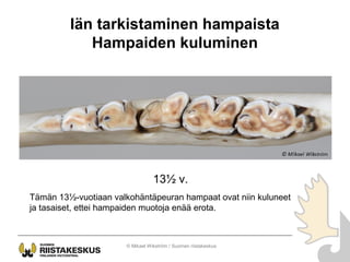 Iän tarkistaminen hampaista
Hampaiden kuluminen
© Mikael Wikström / Suomen riistakeskus
13½ v.
Tämän 13½-vuotiaan valkohän...