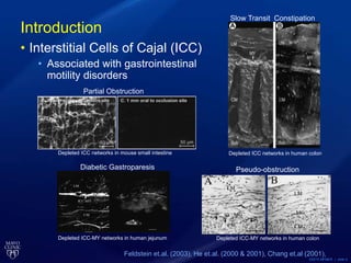 ©2013 MFMER | slide-3
Depleted ICC-MY networks in human jejunum
Diabetic Gastroparesis
Depleted ICC networks in mouse small intestine
Partial Obstruction
Depleted ICC networks in human colon
Slow Transit Constipation
Depleted ICC-MY networks in human colon
Pseudo-obstruction
Introduction
• Interstitial Cells of Cajal (ICC)
• Associated with gastrointestinal
motility disorders
Feldstein et.al. (2003), He et.al. (2000 & 2001), Chang et.al (2001),
 