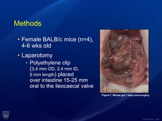 ©2013 MFMER | slide-5
Methods
• Female BALB/c mice (n=4),
4-6 wks old
• Laparotomy
• Polyethylene clip
(3.4 mm OD, 2.4 mm ID,
5 mm length) placed
over intestine 15-25 mm
oral to the ileocaecal valve
Figure 7. Mouse gut 7 days post-surgery
 