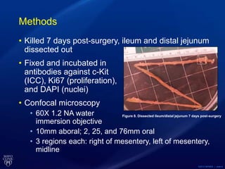 ©2013 MFMER | slide-6
Methods
• Killed 7 days post-surgery, ileum and distal jejunum
dissected out
• Fixed and incubated in
antibodies against c-Kit
(ICC), Ki67 (proliferation),
and DAPI (nuclei)
• Confocal microscopy
• 60X 1.2 NA water
immersion objective
• 10mm aboral; 2, 25, and 76mm oral
• 3 regions each: right of mesentery, left of mesentery,
midline
Figure 8. Dissected ileum/distal jejunum 7 days post-surgery
 