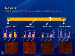 ©2013 MFMER | slide-7
Results
Ki67-positive ICC Count and Network Quality Score
0.25
4.85
3.512
5
4.3
0
2
4
6
0
1
2
10mm Aboral
0.5 0.5
2.9
2.225
2.787
5
0
2
4
6
0
1
2
2mm Oral
0.5 0.5
0.75
2.937
5
4.325 4.375
0
2
4
6
0
1
2
25mm Oral
1.0
0.75
1.25
6.163
3.8
2.48
0
2
4
6
0
1
2
76mm Oral
Oral Aboral
 