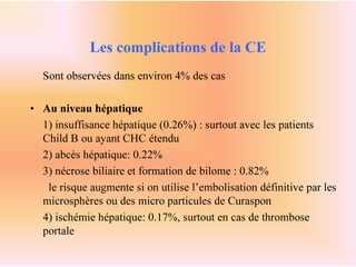 Chimioembolisatiomn Hépatique pour le Cancer du Foie | PPT