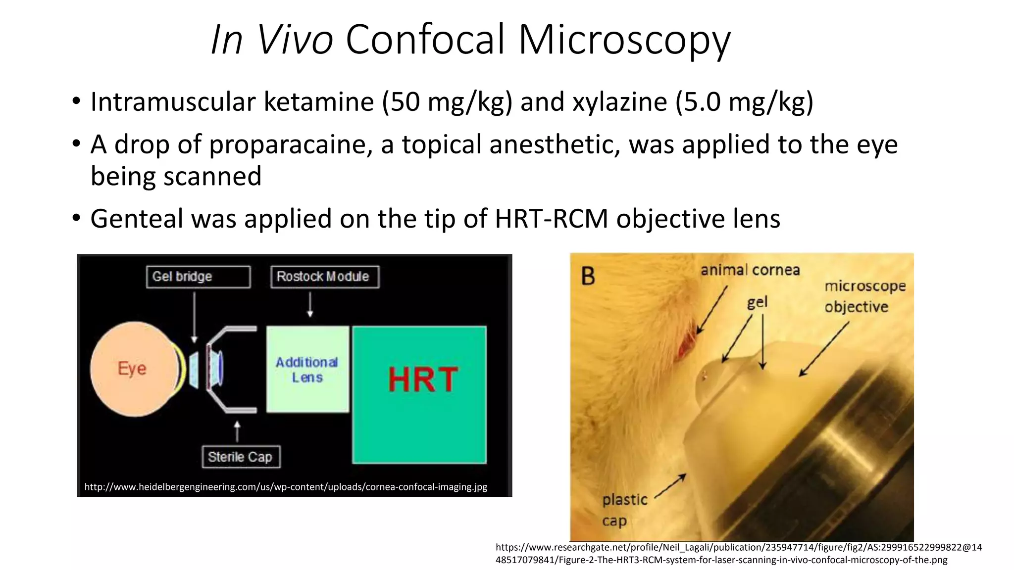 In Vivo Confocal Microscopy
• Intramuscular ketamine (50 mg/kg) and xylazine (5.0 mg/kg)
• A drop of proparacaine, a topical anesthetic, was applied to the eye
being scanned
• Genteal was applied on the tip of HRT-RCM objective lens
http://www.heidelbergengineering.com/us/wp-content/uploads/cornea-confocal-imaging.jpg
https://www.researchgate.net/profile/Neil_Lagali/publication/235947714/figure/fig2/AS:299916522999822@14
48517079841/Figure-2-The-HRT3-RCM-system-for-laser-scanning-in-vivo-confocal-microscopy-of-the.png
 