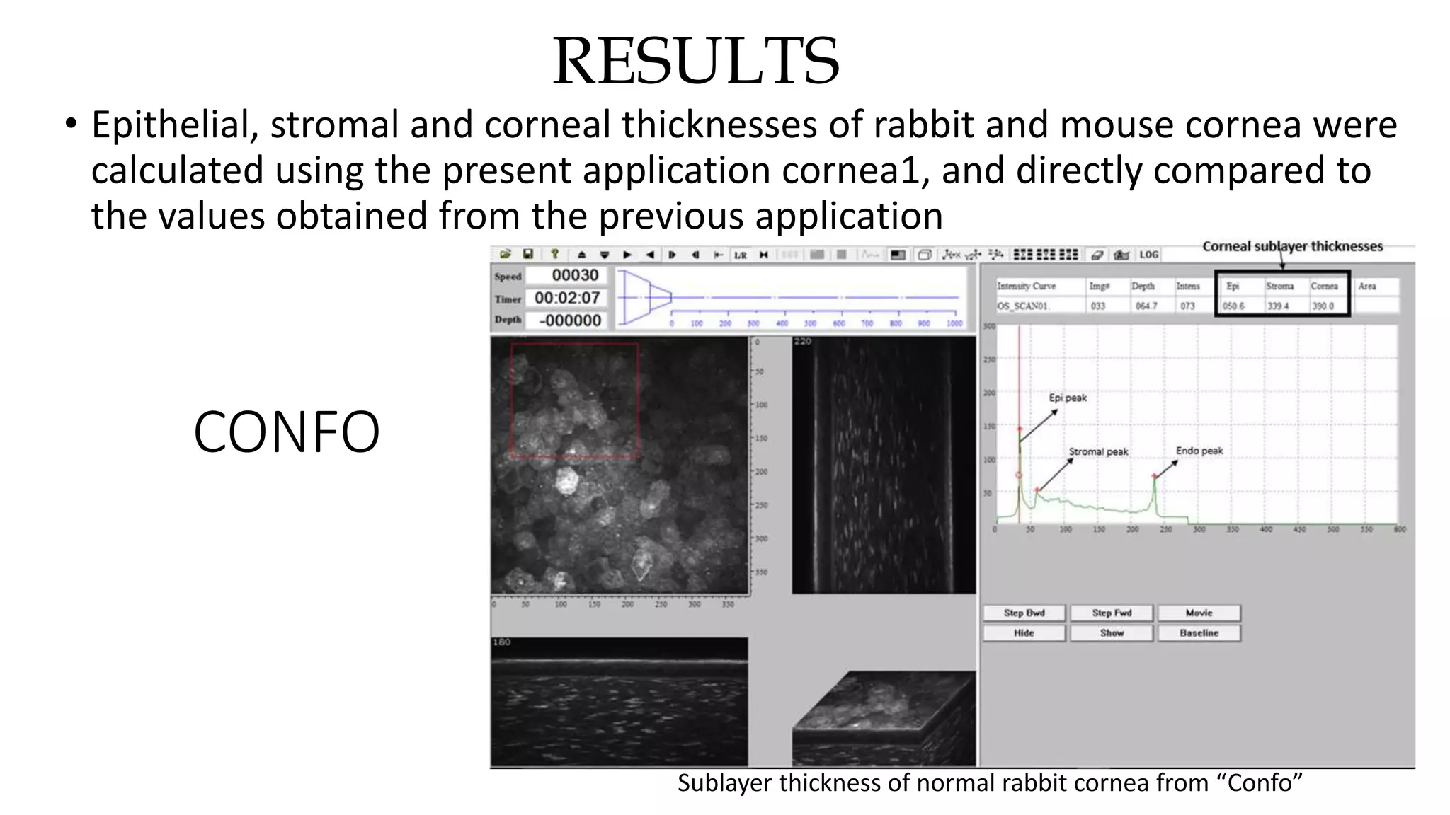 RESULTS
• Epithelial, stromal and corneal thicknesses of rabbit and mouse cornea were
calculated using the present application cornea1, and directly compared to
the values obtained from the previous application
Sublayer thickness of normal rabbit cornea from “Confo”
CONFO
 