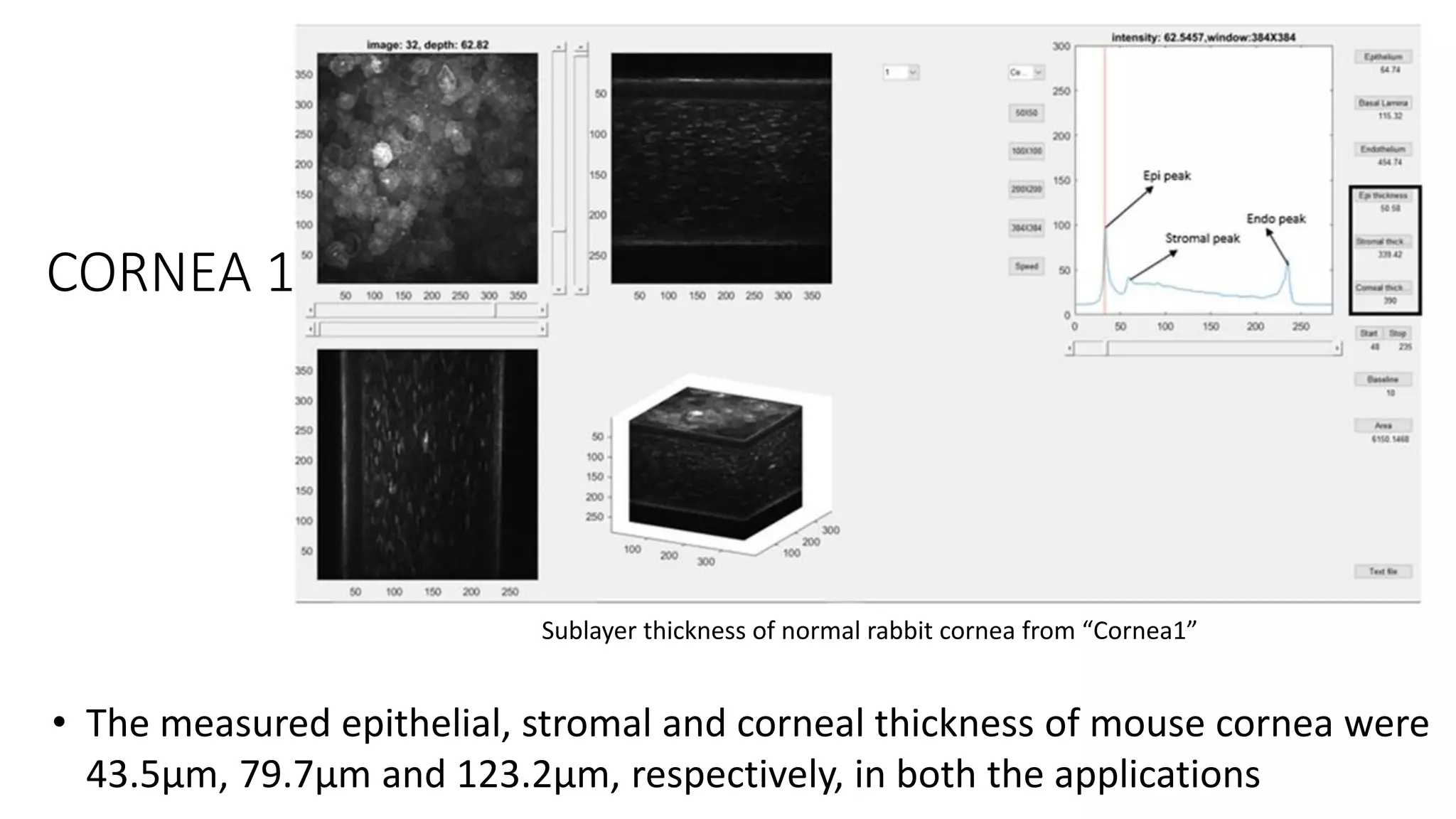 CORNEA 1
• The measured epithelial, stromal and corneal thickness of mouse cornea were
43.5µm, 79.7µm and 123.2µm, respectively, in both the applications
Sublayer thickness of normal rabbit cornea from “Cornea1”
 