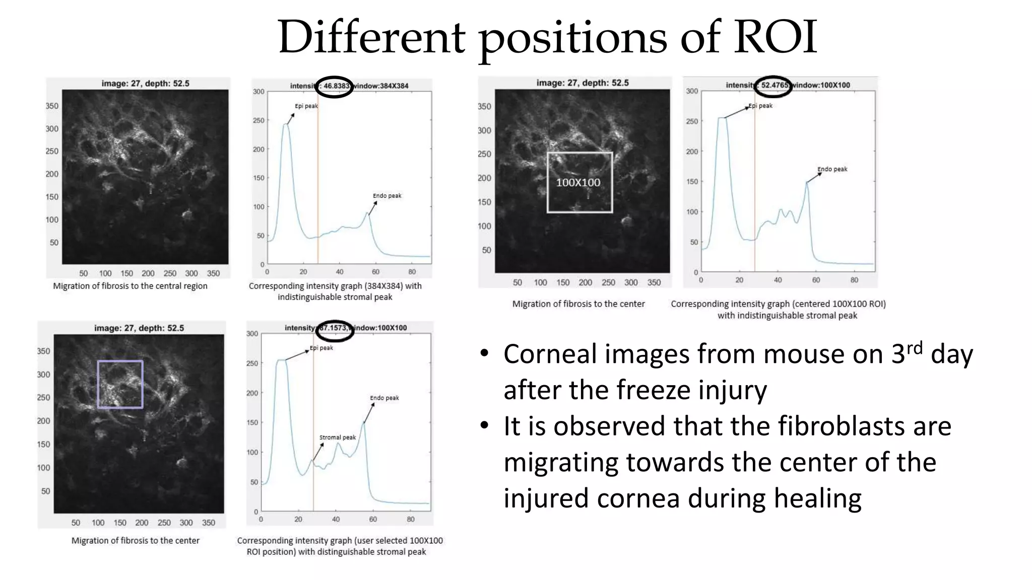 Different positions of ROI
• Corneal images from mouse on 3rd day
after the freeze injury
• It is observed that the fibroblasts are
migrating towards the center of the
injured cornea during healing
 