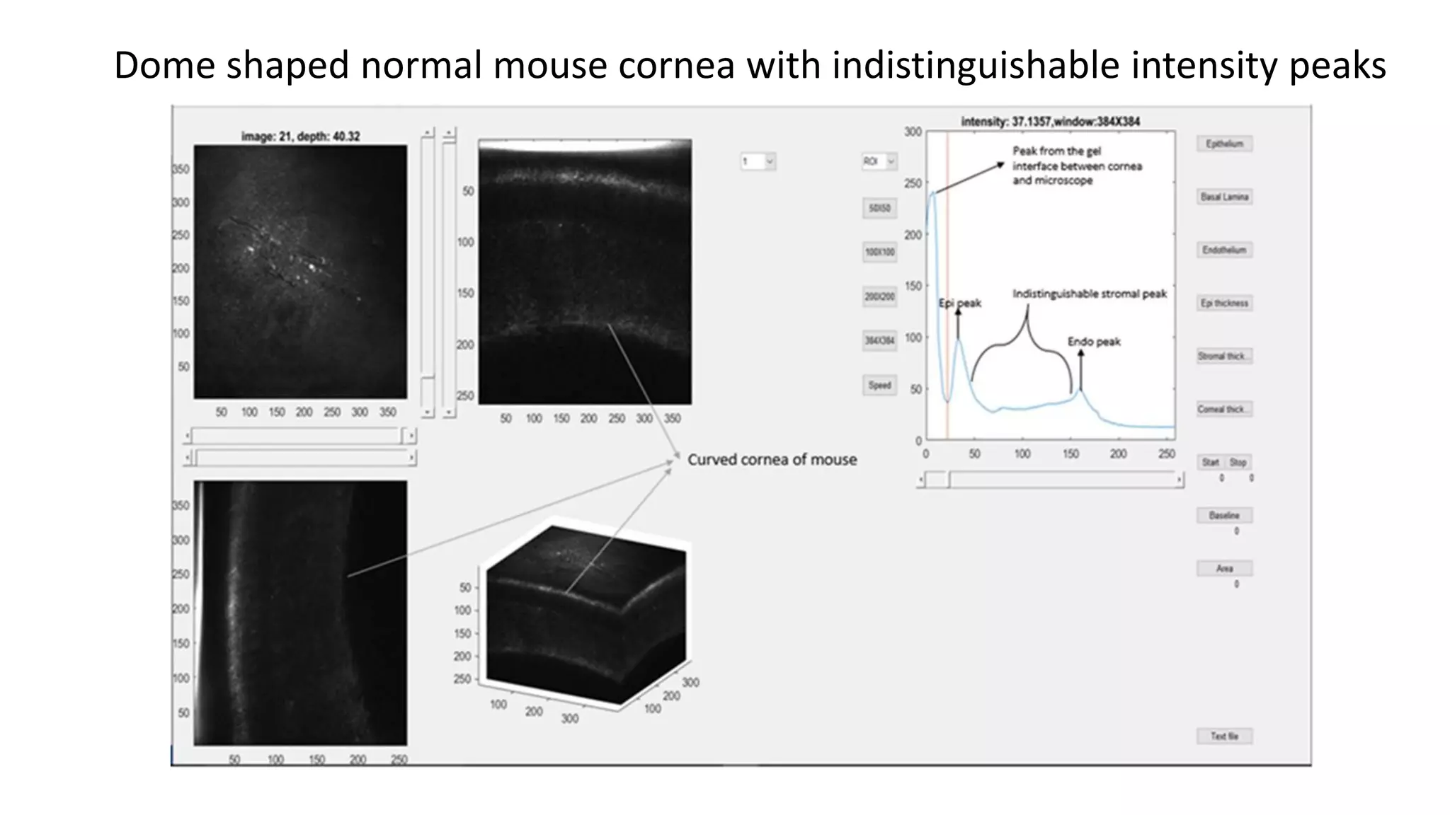 Dome shaped normal mouse cornea with indistinguishable intensity peaks
 