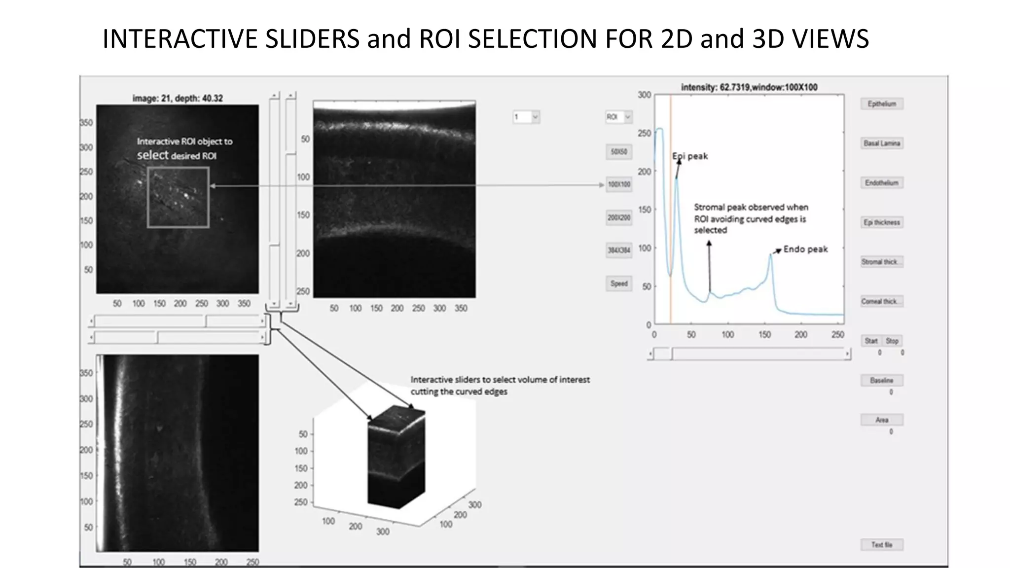 INTERACTIVE SLIDERS and ROI SELECTION FOR 2D and 3D VIEWS
 