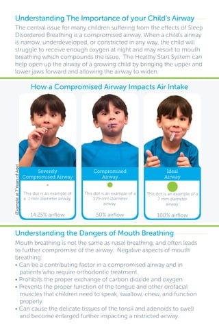 The central issue for many children suffering from the effects of Sleep
Disordered Breathing is a compromised airway. When a child’s airway
is narrow, underdeveloped, or constricted in any way, the child will
struggle to receive enough oxygen at night and may resort to mouth
breathing which compounds the issue. The Healthy Start System can
help open up the airway of a growing child by bringing the upper and
lower jaws forward and allowing the airway to widen.
Understanding The Importance of your Child’s Airway
Mouth breathing is not the same as nasal breathing, and often leads
to further compromise of the airway. Negative aspects of mouth
breathing:
• Can be a contributing factor in a compromised airway and in
patients who require orthodontic treatment.
• Prohibits the proper exchange of carbon dioxide and oxygen
• Prevents the proper function of the tongue and other orofacial
muscles that children need to speak, swallow, chew, and function
properly.
• Can cause the delicate tissues of the tonsil and adenoids to swell
and become enlarged further impacting a restricted airway.
Understanding the Dangers of Mouth Breathing
How a Compromised Airway Impacts Air Intake
(Exampleat7YearsofAge)
Severely
Compromised Airway
This dot is an example of
a 1 mm diameter airway.
14.25% airflow
Ideal
Airway
This dot is an example of a
7 mm diameter
airway.
100% airflow
Compromised
Airway
This dot is an example of a
3.75 mm diameter
airway.
50% airflow
 
