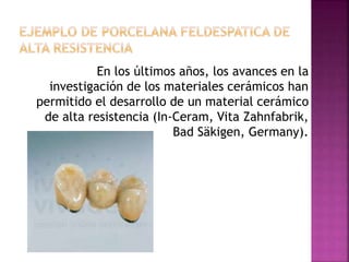 En los últimos años, los avances en la
investigación de los materiales cerámicos han
permitido el desarrollo de un material cerámico
de alta resistencia (In-Ceram, Vita Zahnfabrik,
Bad Säkigen, Germany).
 