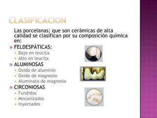 CLASIFICACION	Las porcelanas; que son cerámicas de alta calidad se clasifican por su composición química en:FELDESPÁTICAS:Bajo en leucitaAlto en leucitaALUMINOSASOxido de aluminioOxido de magnesioAluminato de magnesioCIRCONIOSASFundidosMecanizadosInyectados