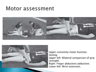 Upper-extremity motor function
testing.
Upper left: Bilateral comparison of grip
strength.
Right: Finger abduction/adduction.
Lower left: Wrist extension.
 