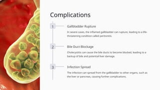(Cholecystitis)CholecystitisCholecystitis.pptx
