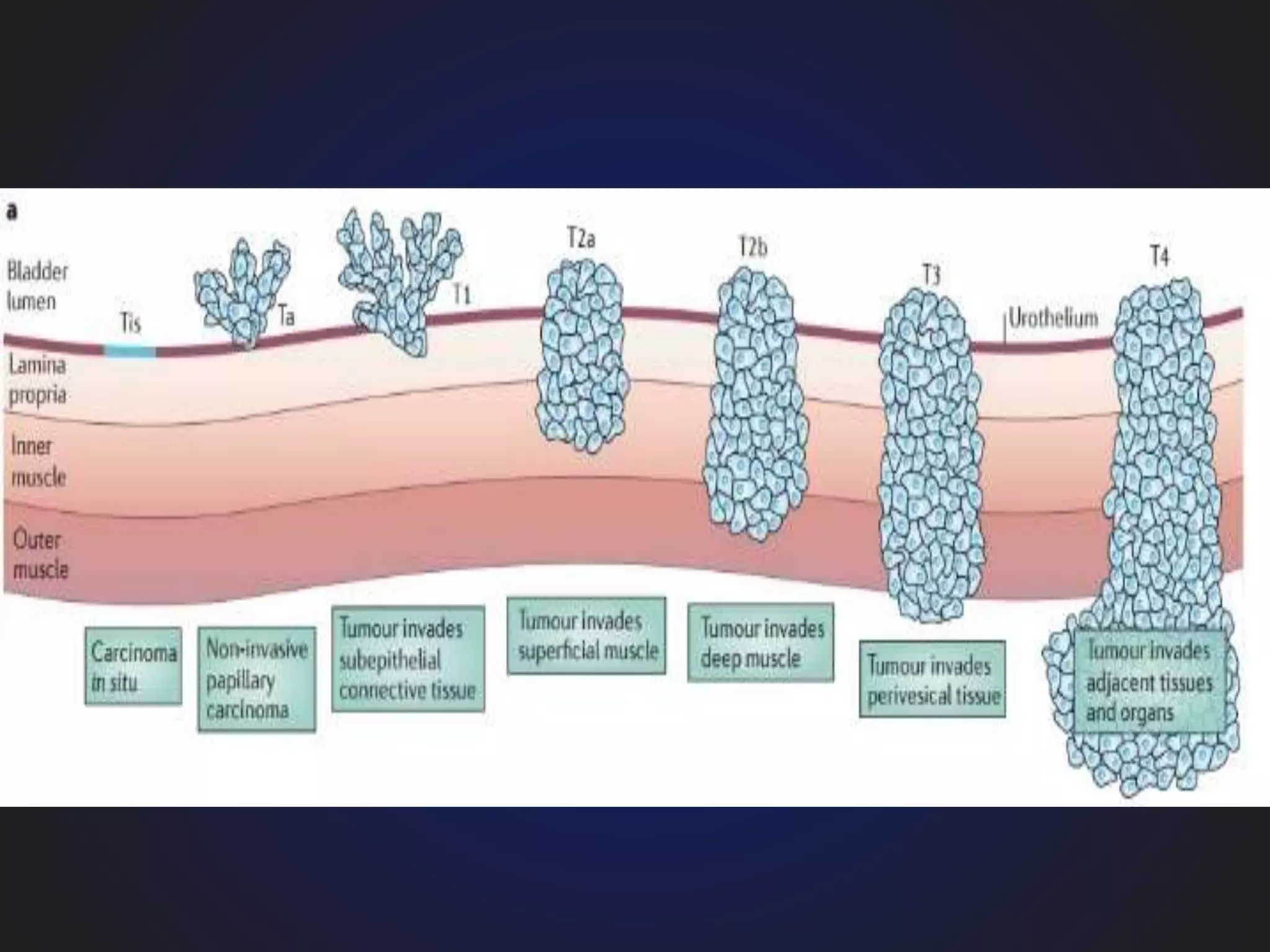 clinical aspects of neoplasia | PPTX