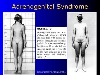 Adrenogenital Syndrome Luria, Z., Friedman, S., and Rose, M.D.  HUMAN SEXUALITY.  New York:  John Wiley & Sons (1987) 