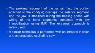 Lecture 6 correction of dentofacial deformities | PPTX