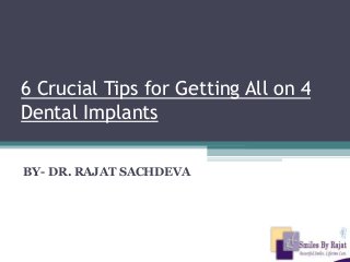 6 Crucial Tips for Getting All on 4
Dental Implants
BY- DR. RAJAT SACHDEVA
 