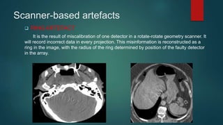 6 CT ARTIFACTS-Rohit.pptx