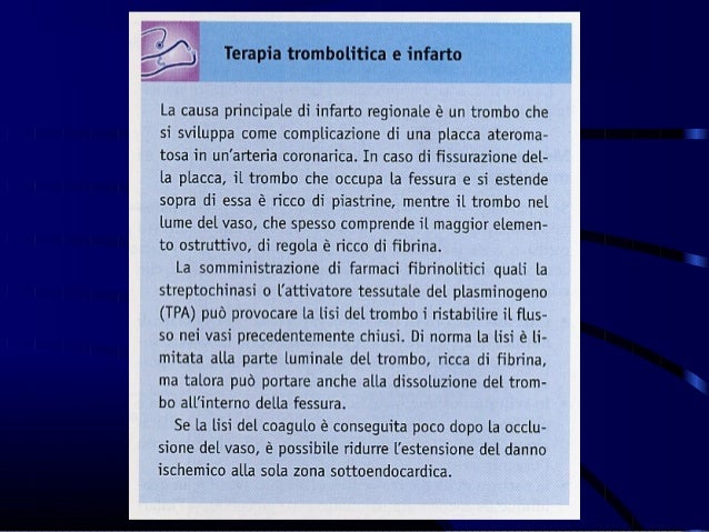 Varicosity trattamento noninvasivo