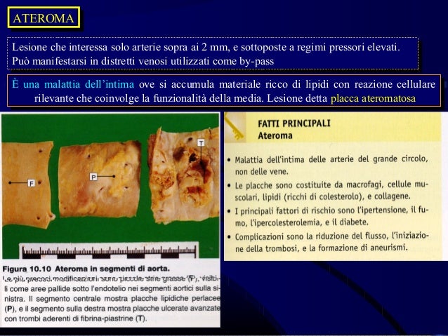Istituti di chirurgia vascolare in Mosca