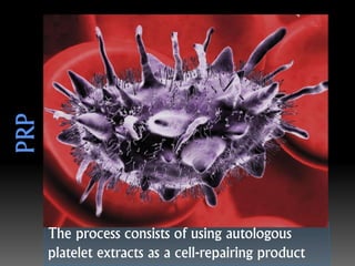 The process consists of using autologous
platelet extracts as a cell-repairing product
 