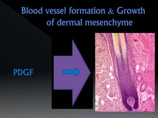 PDGF
 
