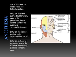 1ml of lidocaine 1%
injected into the
following points:
1) 1,5 cm over the
supraorbital foramen,
deep in the
periosteum, in the
internal third of the
eyebrows
(supraorbital nerve)
2) 1,5 cm medially of
the first point
(supratrochlear nerve)
3) 1,5 cm in front of
the upper part of the
ear helix subdermally
(auriculo-temporal
nerve)
 