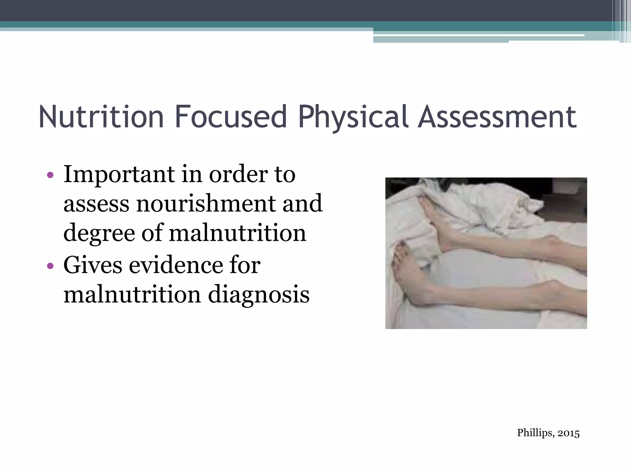 Nutrition Focused Physical Assessment
• Important in order to
assess nourishment and
degree of malnutrition
• Gives evidence for
malnutrition diagnosis
Phillips, 2015
 