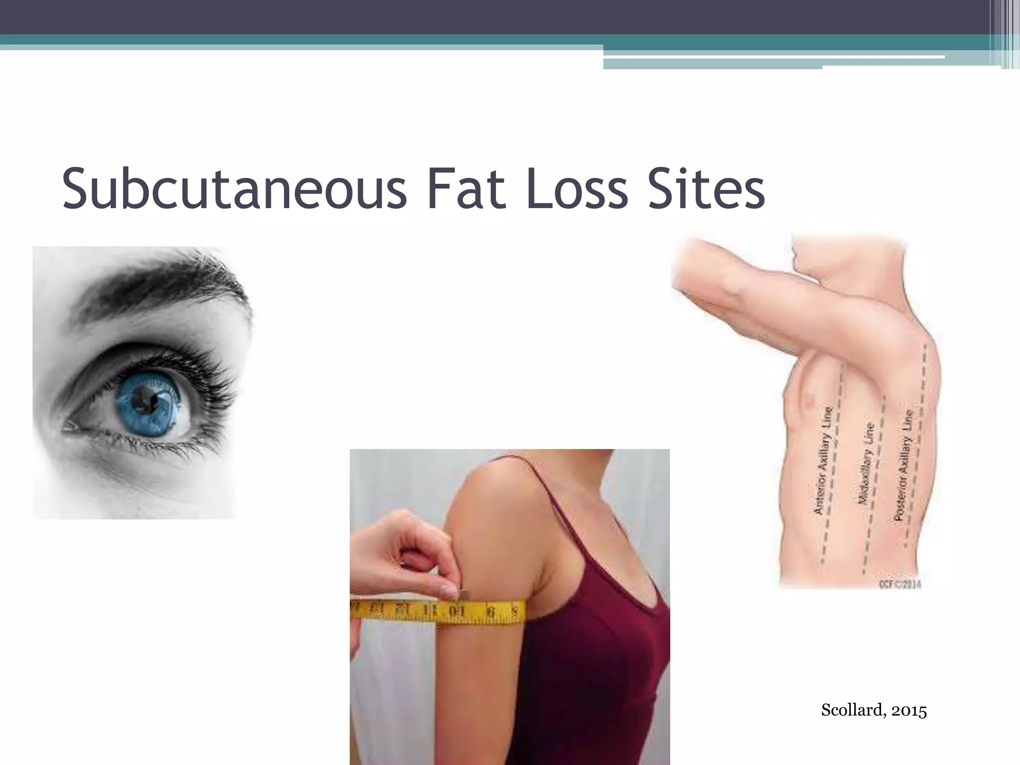 Subcutaneous Fat Loss Sites
Scollard, 2015
 