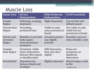Muscle Loss
Exam Area Severe
Malnutrition
Mild-Moderate
Malnutrition
Well Nourished
Temple
Region
Hollowing, scooping,
depression
Slight Depression Can see/feel well-
defined muscle
Clavicle Bone
Region
Protruding,
prominent bone
Visible in male,
some protrusion in
female
Not visible in male,
visible but not
prominent in female
Clavicle and
Acromion
Region
Shoulder to arm joint
looks square,
bones/protrusion
prominent
Acromion process
may slightly
protrude
Rounded, curves at
arms, shoulder, neck
Scapular
Bone Region
Prominent, visible
bones, depressions
between ribs/scapula
or shoulder/spine
Mild depression,
bone may show
slightly
Bones not
prominent, no
significant
depressions
Dorsal Hand Depressed area
between thumb and
forefinger
Slightly depressed Muscle bulges, could
be flat
Scollard, 2015
 