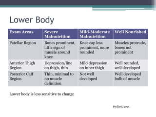 Lower Body
Exam Areas Severe
Malnutrition
Mild-Moderate
Malnutrition
Well Nourished
Patellar Region Bones prominent,
little sign of
muscle around
knee
Knee cap less
prominent, more
rounded
Muscles protrude,
bones not
prominent
Anterior Thigh
Region
Depression/line
on thigh, thin
Mild depression
on inner thigh
Well rounded,
well developed
Posterior Calf
Region
Thin, minimal to
no muscle
definition
Not well
developed
Well developed
bulb of muscle
Lower body is less sensitive to change
Scollard, 2015
 