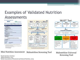 Examples of Validated Nutrition
Assessments
Mini Nutrition Assessment Malnutrition Screening Tool Malnutrition Universal
Screening ToolNestle Nutrition Institute
Abbott Nutrition, 2013
British Association of Parenteral and Enteral Nutrition, 2003
 