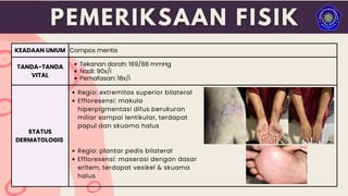 Regio: extremitas superior bilateral
Effloresensi: makula
hiperpigmentasi difus berukuran
miliar sampai lentikular, terdapat
papul dan skuama halus
Regio: plantar pedis bilateral
Effloresensi: maserasi dengan dasar
eritem, terdapat vesikel & skuama
halus
KEADAAN UMUM Compos mentis
TANDA-TANDA
VITAL
Tekanan darah: 169/88 mmHg
Nadi: 90x/i
Pernafasan: 18x/i
STATUS
DERMATOLOGIS
 