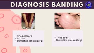 Tinea corporis
Scabies
Dermatitis kontak alergi
Tinea pedis
Dermatitis kontak Alergi
 