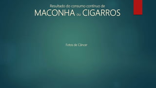 Resultado do consumo contínuo de
MACONHA ou CIGARROS
Fotos de Câncer
 