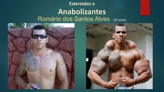 Esteroides e
Anabolizantes
Romário dos Santos Alves (25 anos)
 