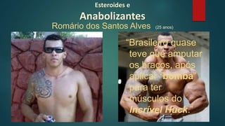 Esteroides e
Anabolizantes
Romário dos Santos Alves (25 anos)
“Brasileiro quase
teve que amputar
os braços, após
aplicar “bomba”
para ter
músculos do
Incrível Huck.”
 