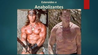Esteroides e
Anabolizantes
 