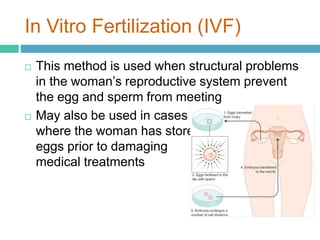 In Vitro Fertilization (IVF) 
 This method is used when structural problems 
in the woman’s reproductive system prevent 
the egg and sperm from meeting 
 May also be used in cases 
where the woman has stored 
eggs prior to damaging 
medical treatments 
 