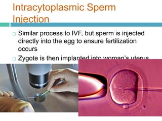 Intracytoplasmic Sperm 
Injection 
 Similar process to IVF, but sperm is injected 
directly into the egg to ensure fertilization 
occurs 
 Zygote is then implanted into woman’s uterus 
 