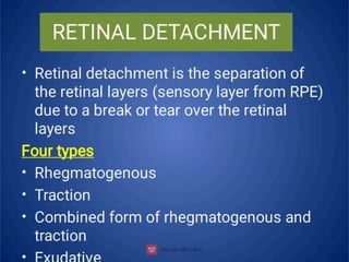 Retinal detachment types of retinal detachment | PPT