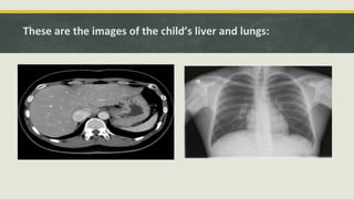 These are the images of the child’s liver and lungs:
 