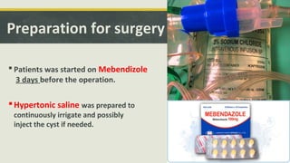 Preparation for surgery
 Patients was started on Mebendizole
3 days before the operation.
Hypertonic saline was prepared to
continuously irrigate and possibly
inject the cyst if needed.
 