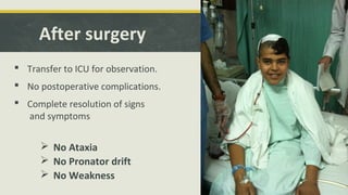 After surgery
 Transfer to ICU for observation.
 No postoperative complications.
 Complete resolution of signs
and symptoms
 No Ataxia
 No Pronator drift
 No Weakness
 