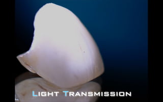 Light Transmission 
 
