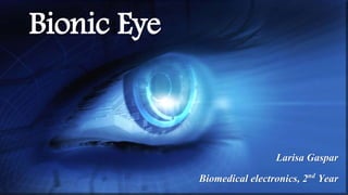Bionic Eye
Larisa Gaspar
Biomedical electronics, 2nd Year
 