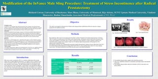 Modification of the InVance Male Sling Procedure: Treatment of Stress Incontinence after Radical
Prostatectomy
Richard Cotran, University of Rochester, Marc Bienz, University of Montreal, Ilija Aleksic, SUNY Upstate Medical University, Vladimir
Mouraviev, Bashar Omarbasha Associated Medical Professionals of NY, PLLC
Abstract Objective
Methods
Results
Results
Conclusion
Introduction
.
INTRODUCTION
Incontinence is not uncommon after radical prostatectomy due to damage to the external urethral
sphincter. In January 2009, the InVance male sling procedure underwent two modifications; releasing
the central tendon and a relocation of the screws more medially on each pubic rami. The aim of this
study is to determine how these modifications influence the outcome of surgery.
METHODS
Patients were classified by date of surgery. Group A (n=25) had the unmodified sling procedure and
group B (n=34) were operated with the modified sling. Post-operative outcomes were compared
between groups using the International Continence Society Male Short Form (ICS-SF) and the Patient
Global Impression of Improvement Scale (PGI-I), using a grading system where low scores indicate
more successful outcomes. The Patient Satisfaction Scale (PSS) was used to determine patient
satisfaction.
RESULTS
Preoperatively, 57 (97%) patients used ≥ 2 pads daily. After surgery 13 (52%) of patients in group A
used ≤1 pad compared to 30 (88%) for group B (p<0.01). The ICS incontinence section showed that a
higher proportion (p<0.05) of group B (79%) had a low score (<10/24) compared to group A (60%).
Results of the PGI-I scale show that group B (68%) had a higher proportion (p<0.05) of positive
response compared to group A (36%). The PSS showed higher satisfaction (p<0.05) of patients in
group B (76%) than in group A (44%).
CONCLUSION
The modified sling procedure suggests more promising results. In fact, there was a significant reduction
in incontinence and improvement in the patients’ satisfaction. In conclusion, the modified sling
procedure improved continence with few risks and no new adverse effects.
Male stress urinary incontinence (SUI) is a common complication after prostate
surgery due to urethral sphincter dysfunction. Low quality of life is common in men
who have problems with SUI. They are generally embarrassed and depressed, and
may experience social isolation. The male sling procedure was developed to help
correct male stress urinary incontinence. The procedure is proving that this option is
most satisfactory for men with mild-to-moderate urinary incontinence (2 to 3 pads per
day or less). One of the distinct advantages of the male sling is that it only requires a
small incision between scrotum base and the anus and involves a fairly short recovery
period.
This study was designed to determine how InVance male sling procedure modifications affect the outcome of surgery
compared to the standard procedure.
We conducted a chart review of our patients and were able to identify 59 patients who had the sling operation. In January
2009, we made two modifications to the InVance male sling procedure: releasing the central tendon and a relocation of the
screws more medially on each pubic rami, in order to restore pelvic floor anatomy to restore continence. Patients were
classified by date of surgery into 2 groups. Group A (n=25) had the original sling procedure while group B (n=34)
underwent the modified procedure.
Post-operative outcomes were compared between groups using the International Continence Society Male Short Form (ICS-
SF) and the Patient Global Impression of Improvement Scale (PGI-I), using a grading system where low scores indicate
better results. The Patient Satisfaction Scale (PSS) was also used to score patient satisfaction.
 The modified sling procedure suggests more promising outcomes.
 There was a significant reduction in incontinence and improvement in the patients’
satisfaction.
 The modified sling procedure improved continence with few risks and no new
adverse effects.
Fig1. Modified InVance technique Fig.3. Final sling placement
Fig. 2. Endoscopic control of sufficient sling suspension to tighten a sphicter
Results Group A
(unmodified)
Group B (modified) p-value
Post-operatively used
<1 pad/day
13 (52%) 30 (88%) p<0.01
ICS-I score <10/24 15 (60%) 27 (79%) p<0.05
PGI-I positive
response
17 (68%) 12 (36%) p<0.05
PSS positive response 11 (44%) 26 (76%) p<0.05
 