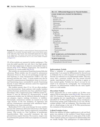 80  Nuclear Medicine: The Requisites
1% of hot nodules are reported to harbor malignancy. The
term hot nodule specifies not only that it has high uptake
but also that suppression of adjacent extranodular tissue is
present (Fig. 6-13). Without suppression, this should be
referred to as a warm nodule (Fig. 6-17).
Hot nodules are autonomous hyperfunctioning follicular
adenomas. Warm nodules may be caused by autonomous
adenomas; however, they are not producing enough thy-
roid hormone to cause thyrotoxicosis (TSH is not sup-
pressed) and thus not “toxic.” A warm nodule may also be
caused by nonautonomous hyperplastic tissue or even nor-
mal functioning tissue surrounded by poorly functioning
thyroid. A toxic follicular adenoma cannot be suppressed
with thyroid hormone.
Hot nodules greater than 2.5 to 3.0 cm often produce
overt thyrotoxicosis. Some patients with smaller nodules
and less hormone production may have subclinical hyper-
thyroidism, with a suppressed serum TSH but normal T4.
Serum T3 may be elevated (T3 thyrotoxicosis). A small
autonomous nodule may be followed clinically because it
can progress, regress, undergo involution, or stabilize.
Increasingly, autonomous nodules are treated at an early
stage because of the low incidence of regression and
adverse consequences associated with subclinical hyper-
thyroidism, (e.g., bone mineral loss).
Radioiodine I-131 is the usual therapy for toxic nodules
because the radiation is delivered selectively to the hyper-
functioning tissue while sparing suppressed extranodular
tissues. This results in a low incidence of posttherapy
hypothyroidism. After successful treatment, the sup-
pressed tissue regains function. On occasion, surgery may
be performed for patients with local symptoms or cosmetic
concerns.
Indeterminate Nodule
When a palpable or sonographically detected nodule
greater than 1 cm cannot be differentiated by thyroid scan
as definitely hot or cold compared to surrounding normal
thyroid, it is referred to as an indeterminate nodule. This may
occur with a posterior nodule that has normal thyroid
uptake superimposed anterior to it, making it appear to
have normal uptake. Nodules less than 1 cm may be too
small to be detected by scintigraphy. For management
purposes, an indeterminate nodule has the same signifi-
cance as a cold nodule.
Discordant Nodule
Some apparently hot or warm nodules on Tc-99m scans
appear cold on radioiodine scans (Fig. 6-18). This occurs in
only 5% of patients. Because some thyroid cancers main-
tain trapping but not organification, a single hot nodule
identified on Tc-99m imaging should not be considered a
functioning nodule until confirmed by I-123 scan. Of dis-
cordant nodules, 20% are malignant. The discordant nod-
ule is a disadvantage to the use of Tc-99m pertechnetate
for evaluation of thyroid nodules.
Colloid Nodular Goiter
Before the addition of iodine supplements to salt and food,
goiter was endemic in the northern United States around
the Great Lakes and still occurs in some parts of the world.
These endemic goiters are composed of colloid nodules that
are usually benign. The pathogenesis of iodine-deficient
Figure 6-17.  Warm nodule in euthyroid patient. Patient presented with
a palpable 1.5-cm nodule. Increased uptake is seen in the inferior aspect
of the right lobe of the thyroid. The extranodular gland does not appear
to be suppressed. The patient had normal thyroid function tests. The
warm nodule may be autonomous, but it is not a toxic nodule. Compare
to Figure 6-13.
	Box 6-5.  Differential Diagnosis for Thyroid Nodules
COLD NODULES (NONFUNCTIONING)
Benign
Colloid nodule
Simple cyst
Hemorrhagic cyst
Adenoma
Thyroiditis
Abscess
Parathyroid cyst or adenoma
Malignant
Papillary
Follicular
Hurthle cell
Anaplastic
Medullary
Lymphoma
Metastatic carcinoma
Lung
Breast
Melanoma
Gastrointestinal
Renal
HOT NODULES (AUTONOMOUS FUNCTION)
Toxic follicular adenomas
WARM NODULES
Nontoxic hyperfunctioning adenomas
Hyperplastic thyroid tissue
 
