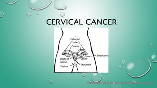 CERVICAL CANCER
PRESENTATION BY STACEY-ANN ELLIS
 