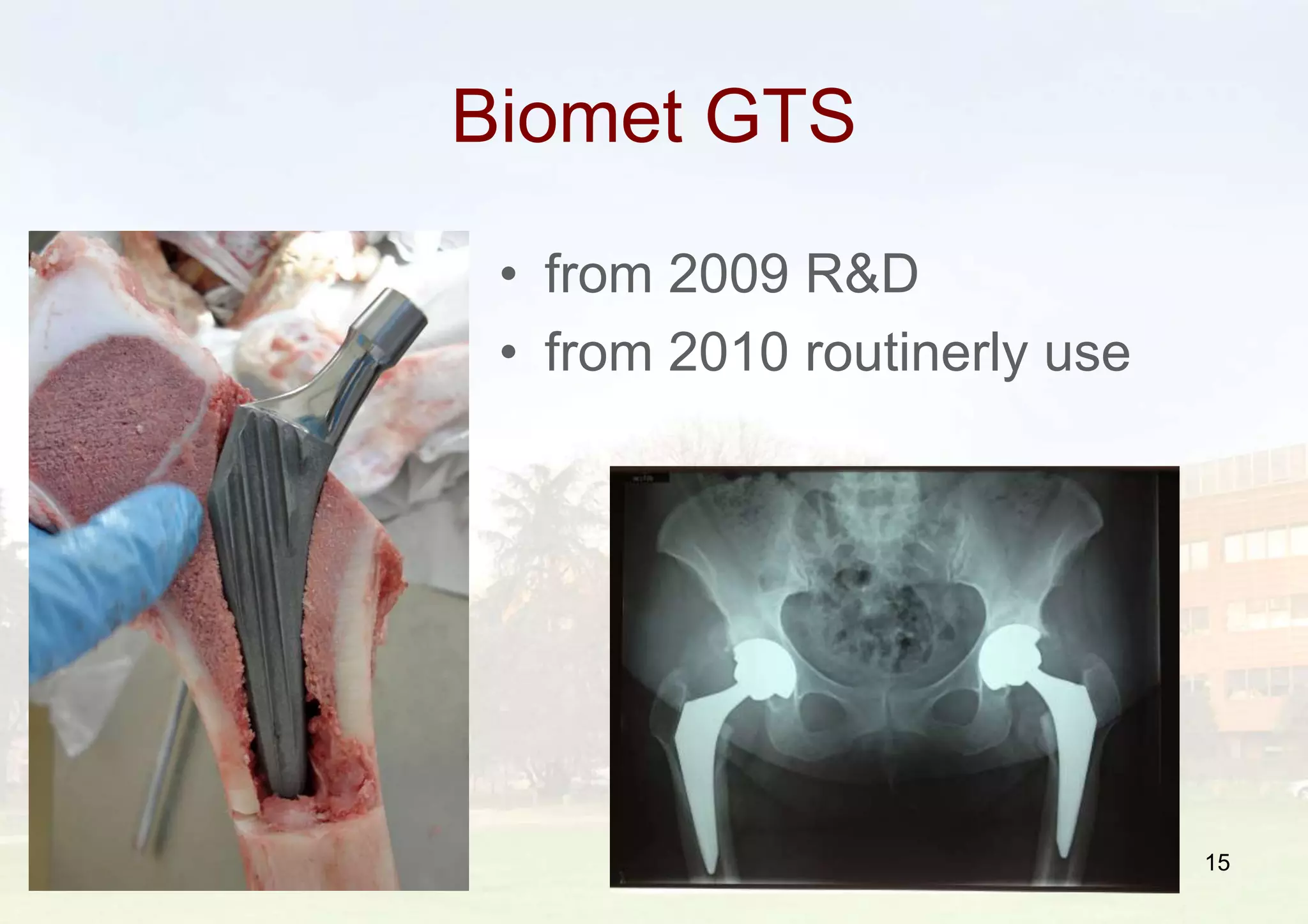 Biomet GTS
• from 2009 R&D
• from 2010 routinerly use
15
 